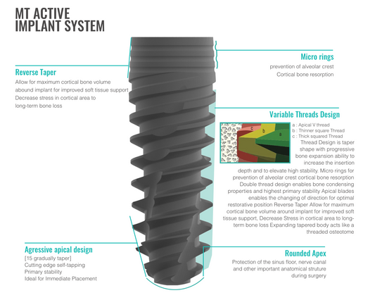 MT Active Implant System